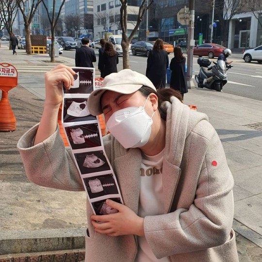 황신영 "세쌍둥이 임신...행복하지만 겁도 나"