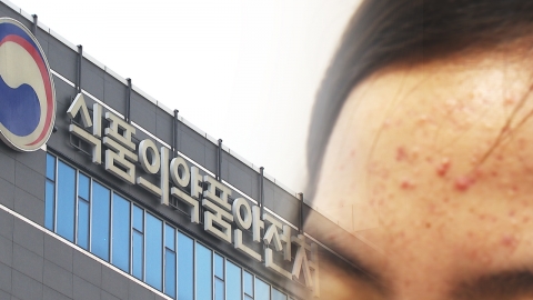 여드름약 '이소트레티노인' 복용할 땐 피임해야