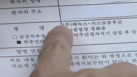 효과 좋아도 못 쓰는 뇌전증 치료약…"10번 중 6번 발작하면 비보험"