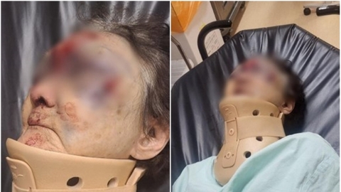 "폭행 목격자 찾아요" 실종 6시간 만에 멍투성이로 발견된 치매 노인