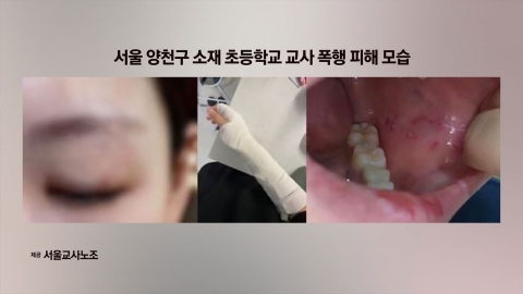 교사 폭행 초등 6학년 전학 결정...최고수위 처분