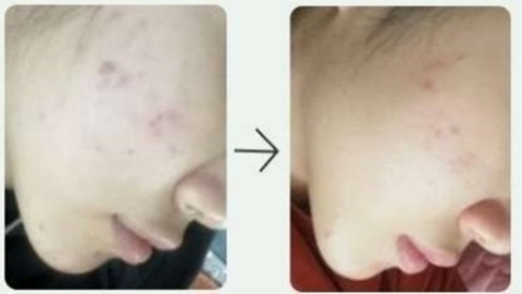 염증 억제·주름 개선 등 SNS상 화장품 허위 광고 속지 마세요