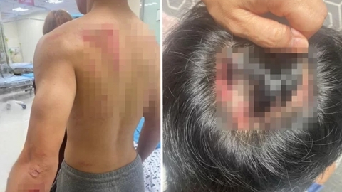 경찰, 흉기 난동 오해 받은 중학생에 "사과와 보상 진행 중" 