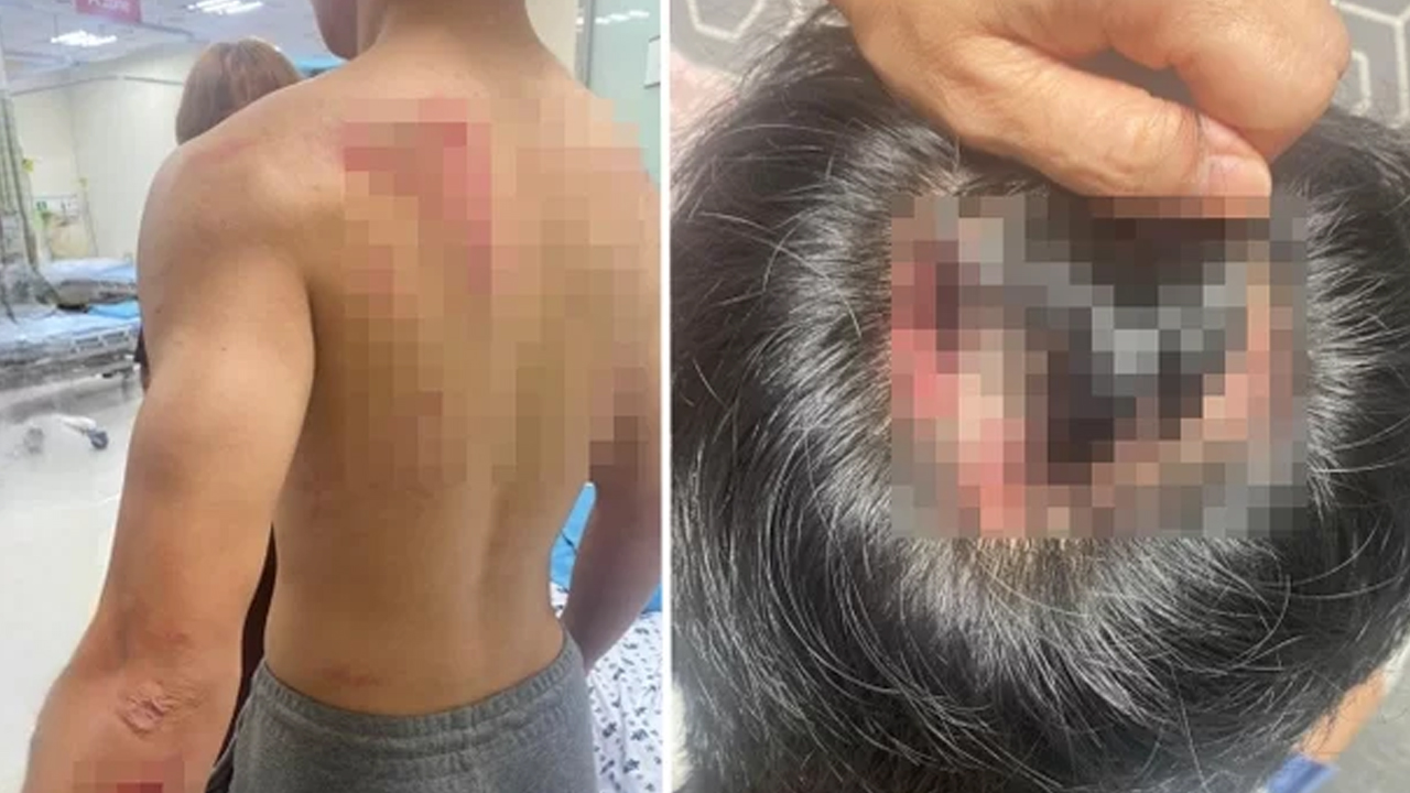 경찰, 흉기 난동 오해 받은 중학생에 "사과와 보상 진행 중"