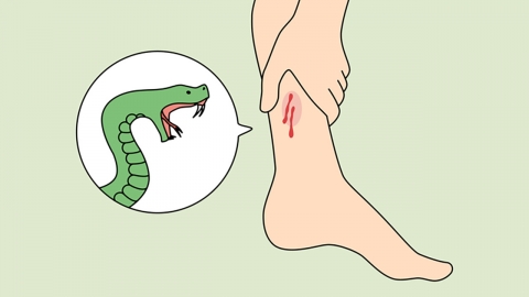 응급처치 잘못했다가 피부 괴사…뱀에 물렸을 때 행동 요령은?