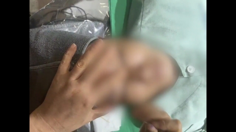 72차례 무면허 성형 수술한 간호조무사…중국 원정도 뛰었다