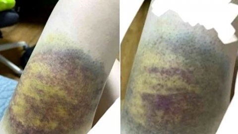 "무료과외 해준다더니 피멍 들도록 폭행"…피해 학생, 고소장 제출