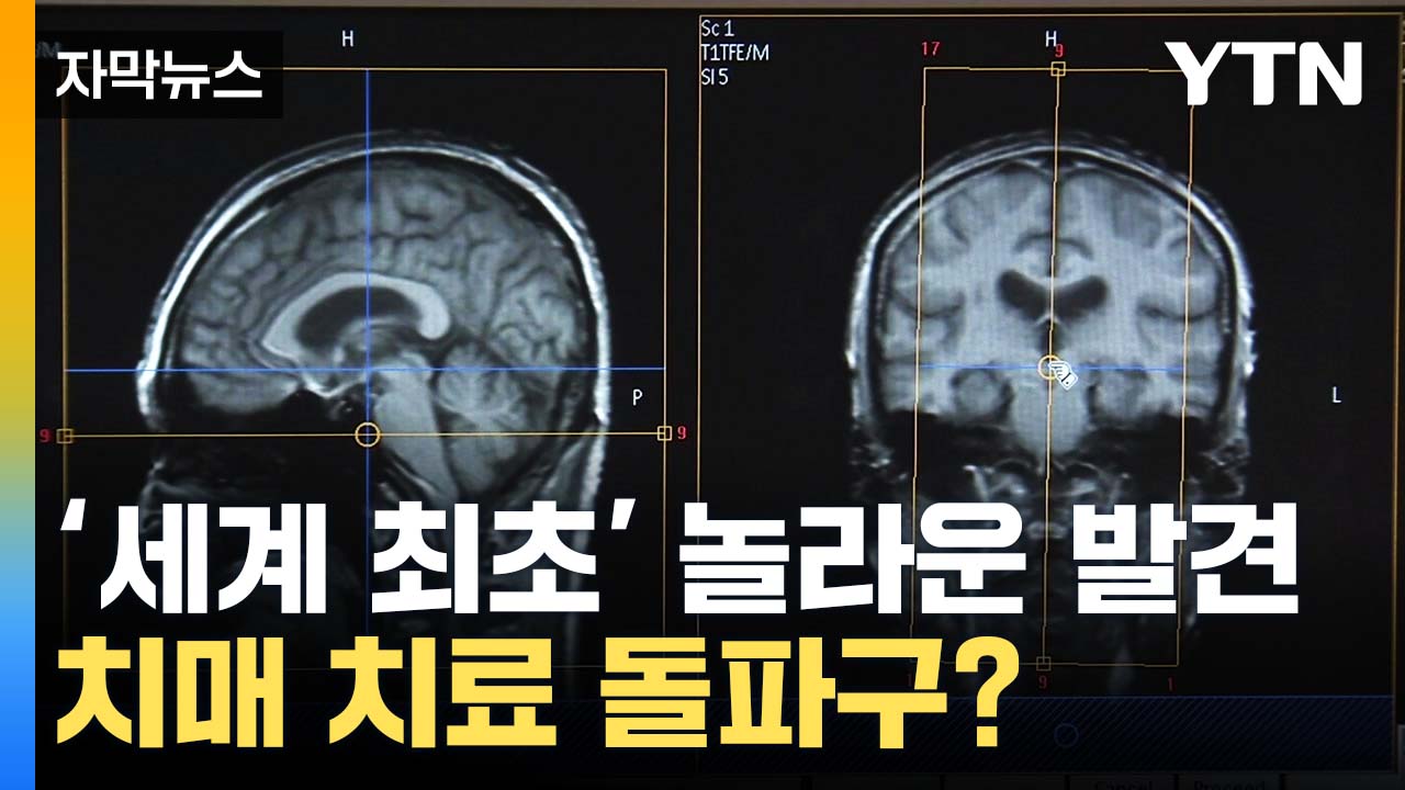 [자막뉴스] 국내 연구진의 놀라운 발견...'치매 치료' 돌파구 될까