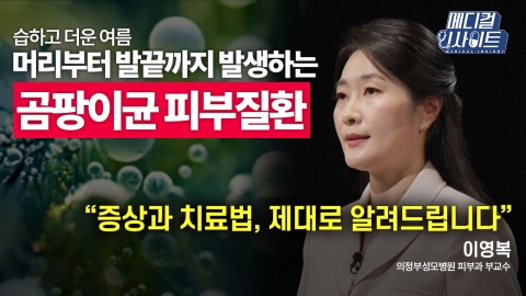 [메디컬 인사이트 37회] 피부과 전문의가 전하는 '곰팡이균 피부질환의 증상과 치료법'