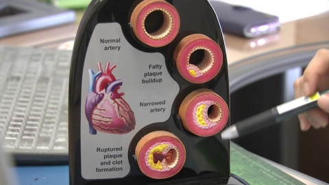 \'무증상의 시한폭탄\' 혈관질환 막으려면?…"생활습관 중요"