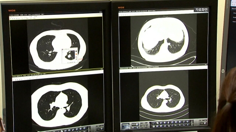 암 사망률 1위 폐암…유전자 가위 활용해 40분 만에 진단