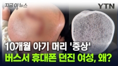 휴대전화에 머리 맞은 아기 \'중상\'...버스에서 무슨 일이? [지금이뉴스]