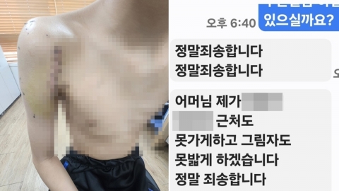 학폭 후유증 여전한데…가해자와 같은 학교 배정한 교육청