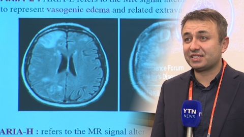 치매 극복도 \'K-의료\'…"AI 접목 치매 예방·치료"