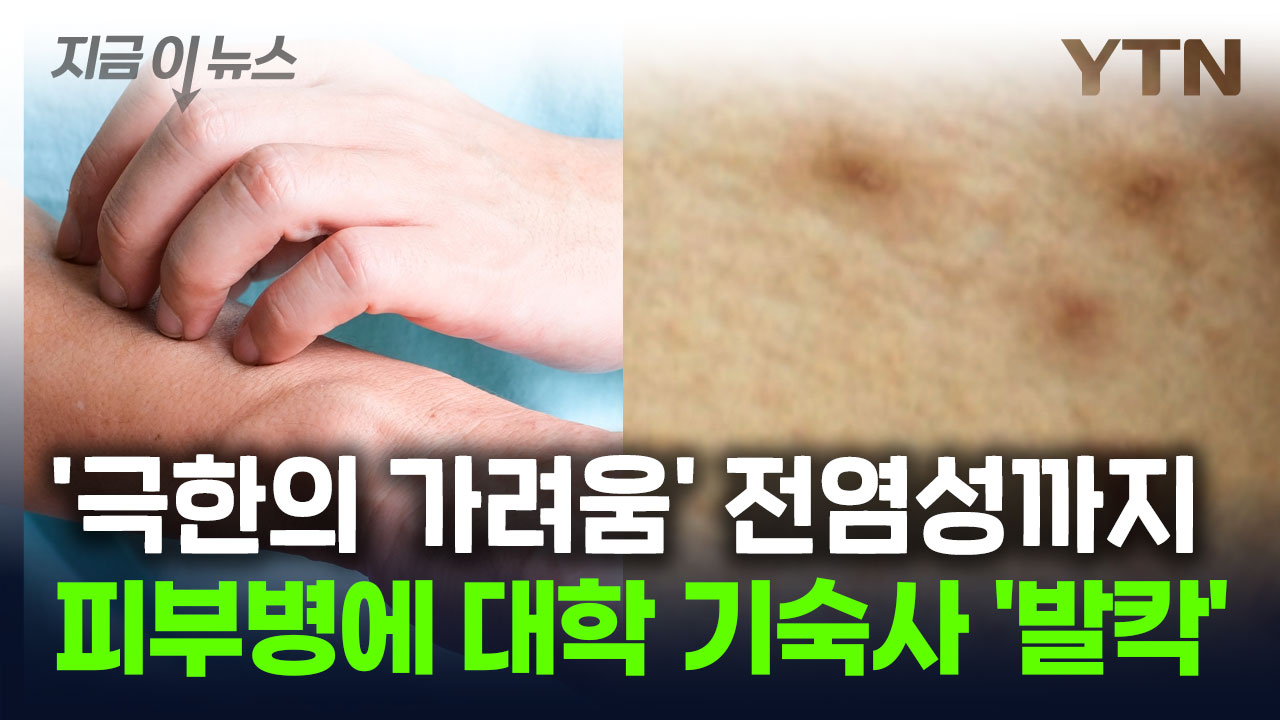 전염성 피부병에 대학 기숙사 '발칵'..."학생 2명 감염" [지금이뉴스]