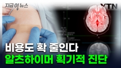 [지금이뉴스] 간단한 피검사로 알츠하이머 진단...FDA 첫 승인