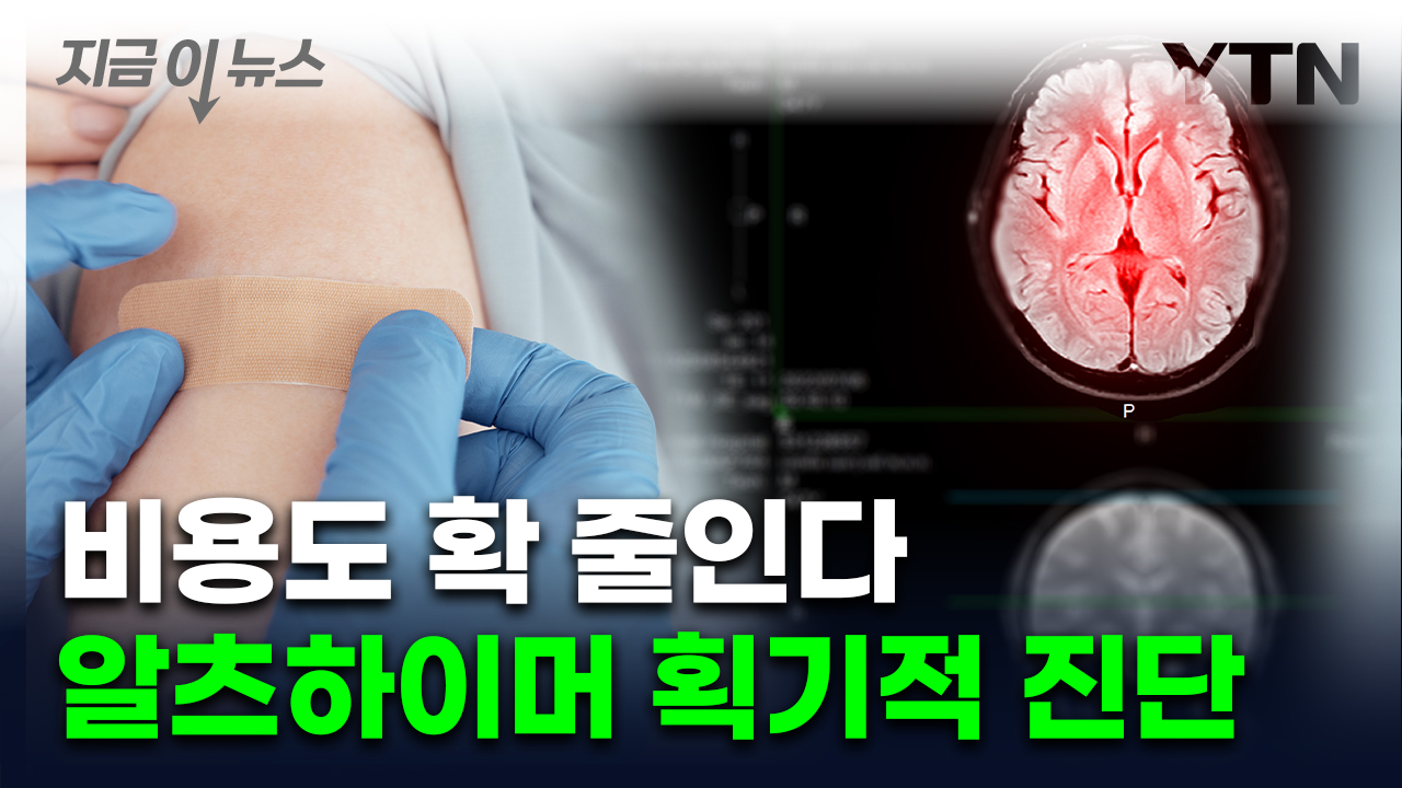 [지금이뉴스] 간단한 피검사로 알츠하이머 진단...FDA 첫 승인