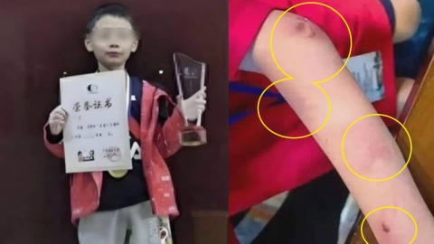 "질 때마다 父가 폭행"…9세 \'바둑 신동\' 극단적 선택