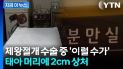 "영구적 흉터"... 수술 중 태아 이마에 상처 낸 의사가 받은 처벌 [지금이뉴스] 