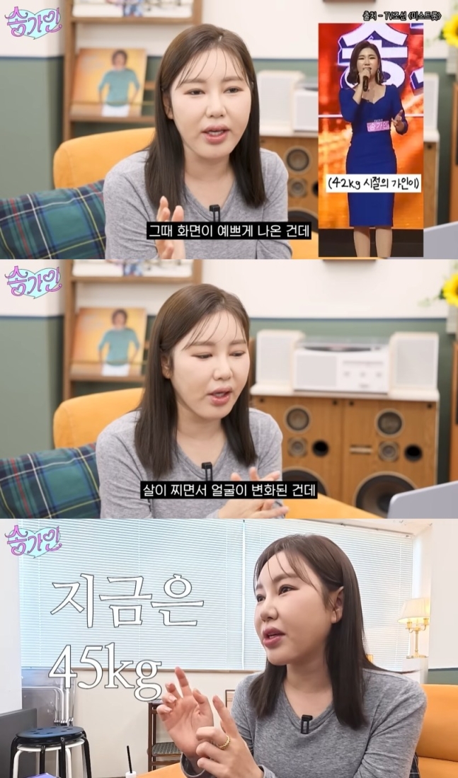 송가인, 외모 악플에 "얼굴 가지고 뭐라 해서 다이어트 중…현재 45kg"