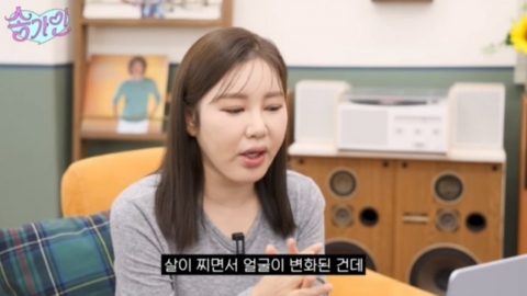 송가인, 외모 악플에 