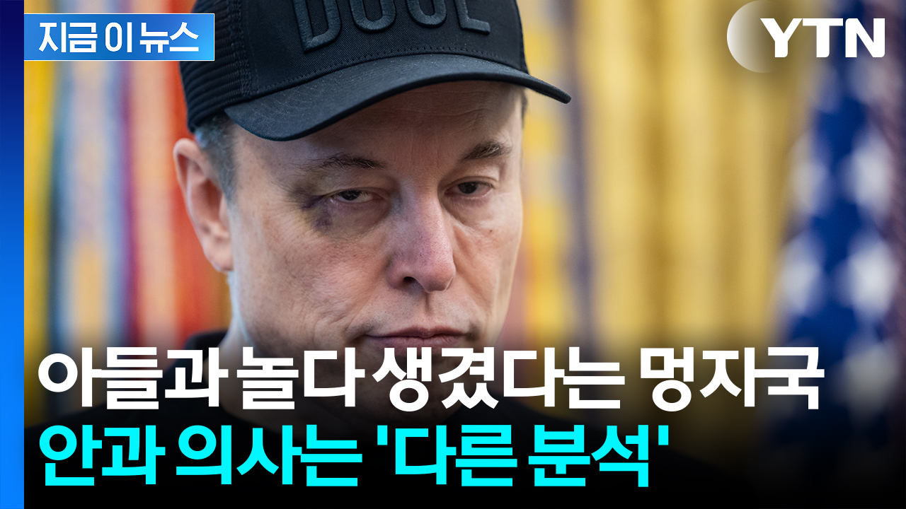 머스크 눈에 ' 검은 멍자국'...의문 제기한 안과전문의 "단순한 충격 아냐" [지금이뉴스]