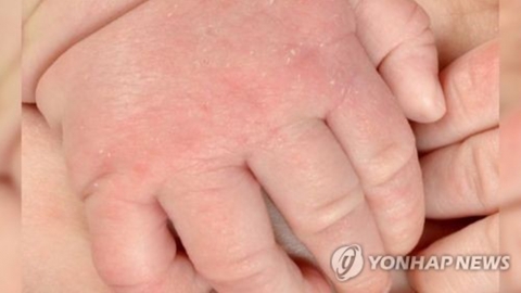 심장마비로 숨진 아빠 팔에 깔려 3개월 아기도 사망