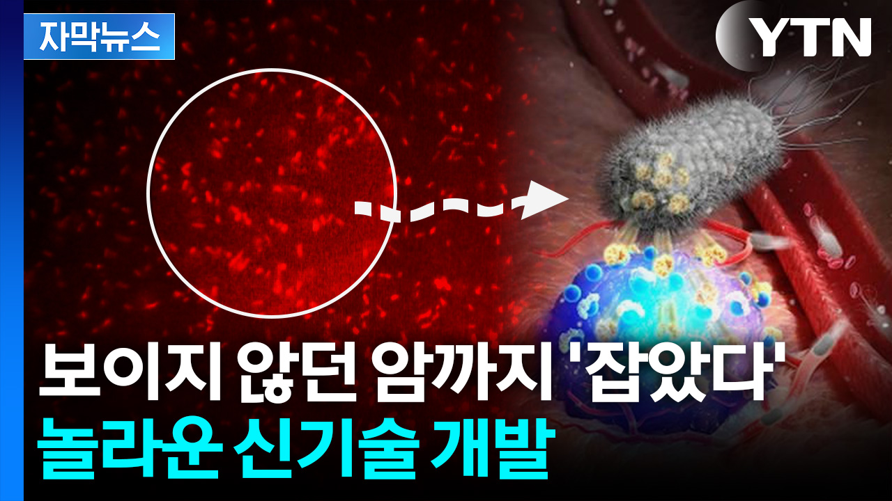 [자막뉴스] "다양한 암에 적용 가능"... 박테리아가 '열쇠' 될까