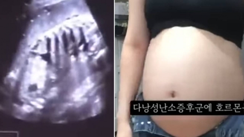 논란의 \'36주 낙태 영상\'…병원장·집도의 살인 혐의로 구속 송치