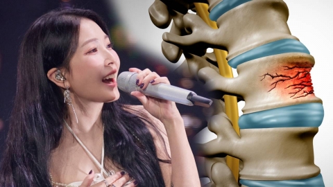 "뼈 조직이 죽는다"…보아 진단받은 \'골괴사\' 뭐길래