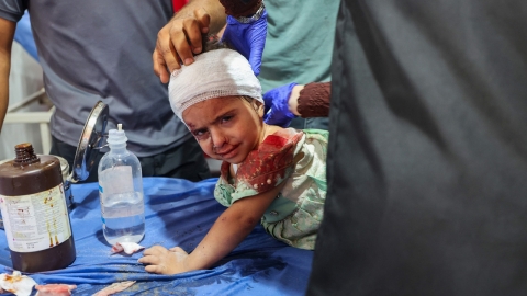 스코틀랜드 수반, 영국 총리에 "가자지구 부상 어린이들 받자"