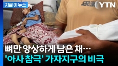 생후 6주 아기도 굶주림에 사망...거대한 아우슈비츠가 되어버린 가자지구 [지금이뉴스]