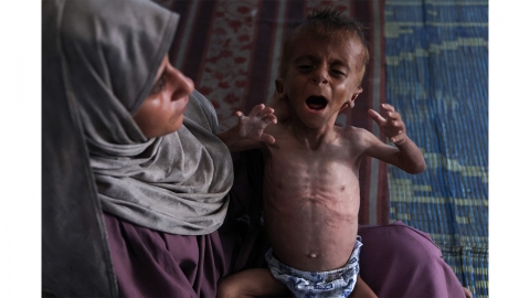 "가자주민 ⅓ 며칠째 굶어"...유엔 "9만 명 사망 위기"