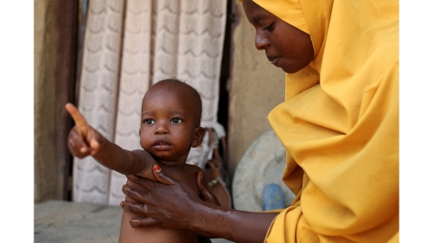 '국제원조 중단' 미, 보관 중인 아프리카행 의약품 소각 방침