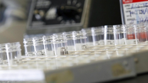 AI가 슈퍼버그 신약 2종 설계...항생제 제2황금기 온다