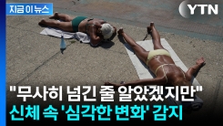 \'훅\' 늙어버릴 수도...가속 노화 만드는 의외의 주범 [지금이뉴스] 