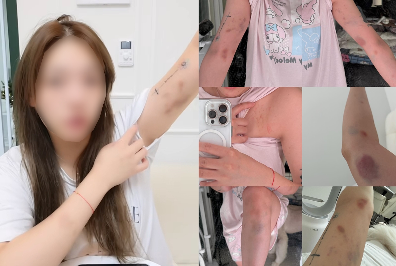 홍대서 폭행당한 타이완 여성 "경찰이 가해자들 풀어줘"