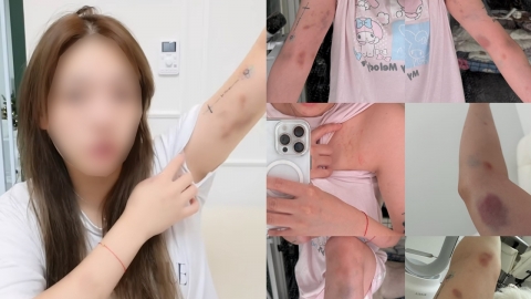 홍대서 폭행당한 타이완 여성 "경찰이 가해자들 풀어줘"