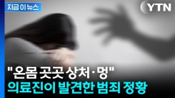 "10대 딸, 범죄 사망 의심"...구속된 건 친모였다 [지금이뉴스]
