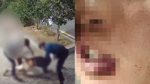 "경찰관이 말다툼 도중 과잉 체포"…신고자 갈비뼈 골절