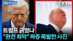 잡지 표지에서 머리카락 실종?..."형편 없어" 펄펄 뛴 트럼프 [지금이뉴스] 