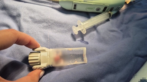 가짜 종양 진단하고 미용시술…보험금 빼돌린 의사 구속