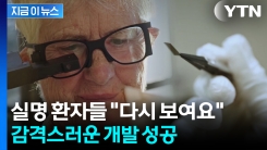 실명 환자들 \'시력 회복\' 길 열렸다..."전례없는 성과" [지금이뉴스]