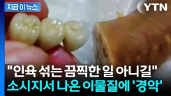 중국 비위생 \'상상초월\'...딤섬·소시지서 나온 인공치아에 \'발칵\' [지금이뉴스]