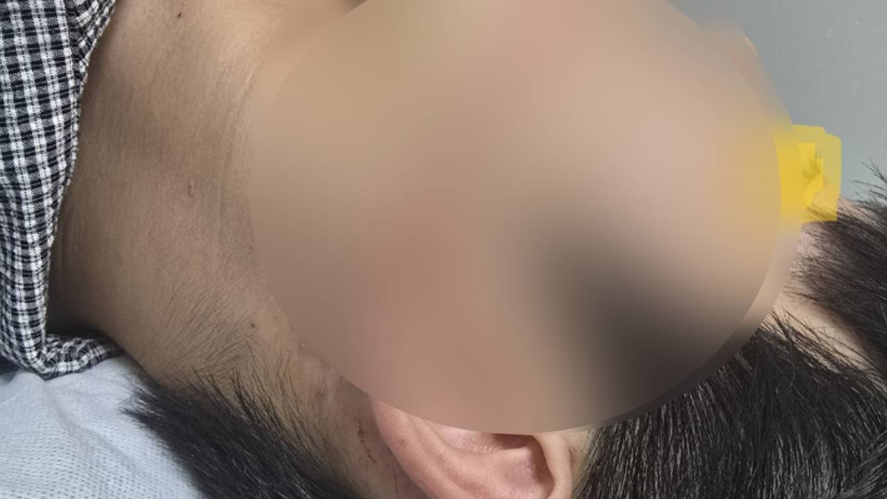 축제 도중 워터건 맞아 얼굴 찢어진 대학생, 주최측 고소
