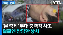 \'물 축제\' 워터건 참사...피해 대학생 "누구도 책임지려하지 않는다" 호소 [지금이뉴스] 
