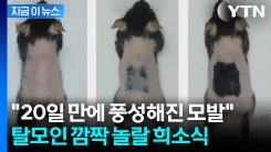 타이완 연구진 ‘모낭 재생 세럼’ 개발...20일 만에 모발 복원 성공 [지금이뉴스]