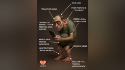 복부 비만에 거북목·탈모...AI가 예측한 25년 뒤 인류