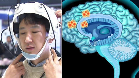 "초음파로 뇌 청소"…치매 치료기기 나온다