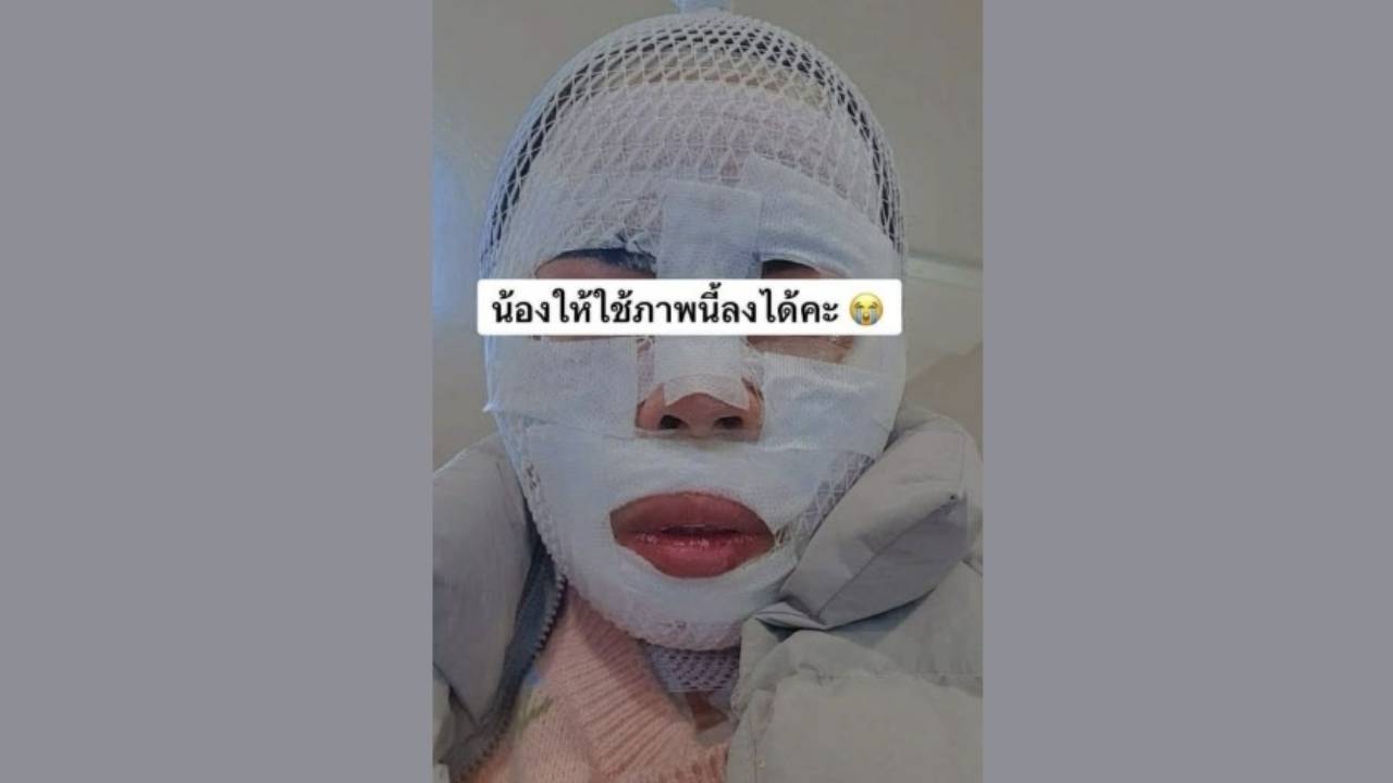 "다른 남자 만날까 봐"...태국인 아내 얼굴에 끓는 물 부은 남편